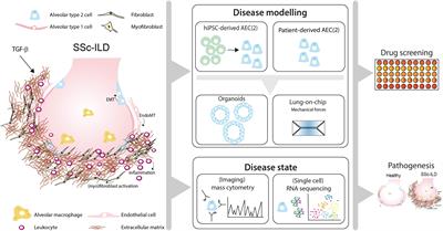 Interstitial Lung Disease in Patients With Systemic Sclerosis: Toward Personalized-Medicine-Based Prediction and Drug Screening Models of Systemic Sclerosis-Related Interstitial Lung Disease (SSc-ILD)